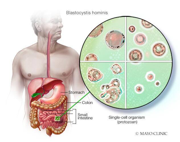 Blastocystis hominis