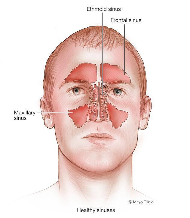 Healthy sinuses