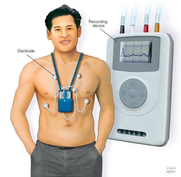 Holter monitor