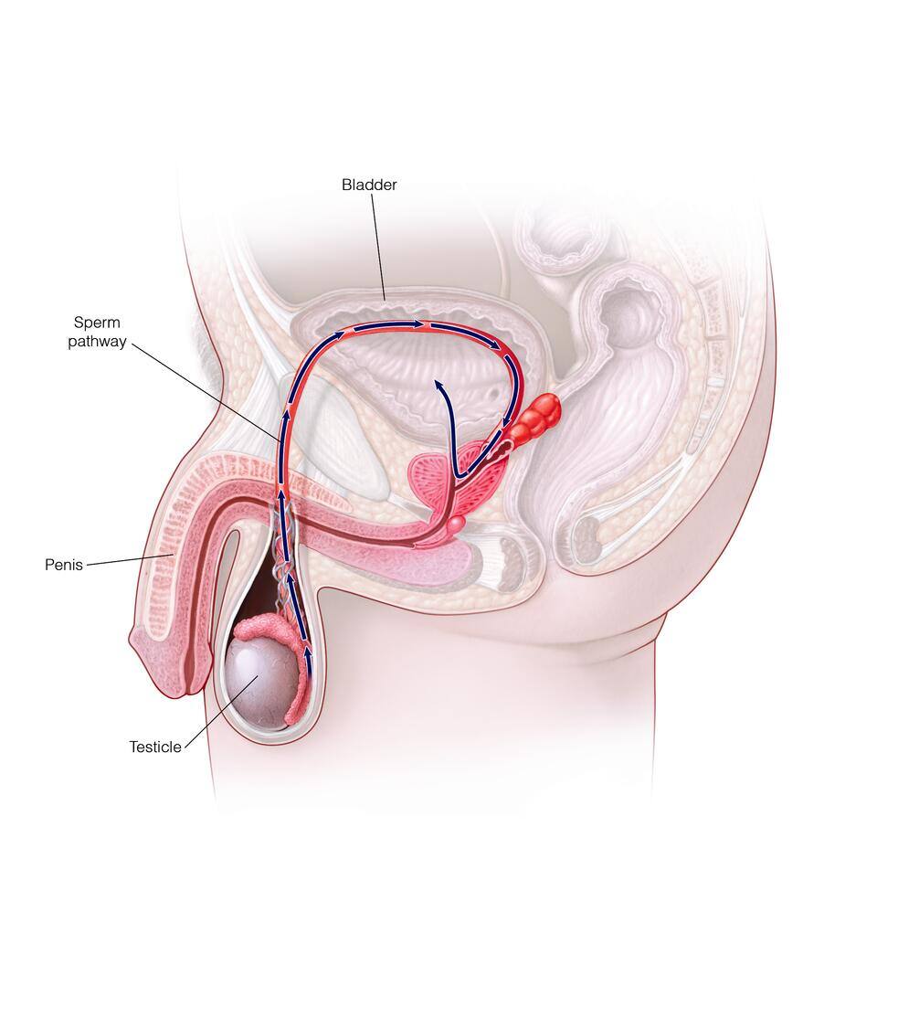 Retrograde ejaculation