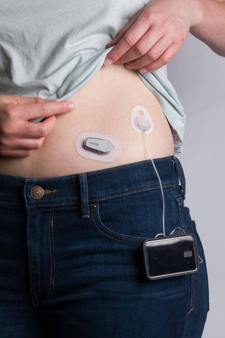 Continuous glucose monitor and insulin pump