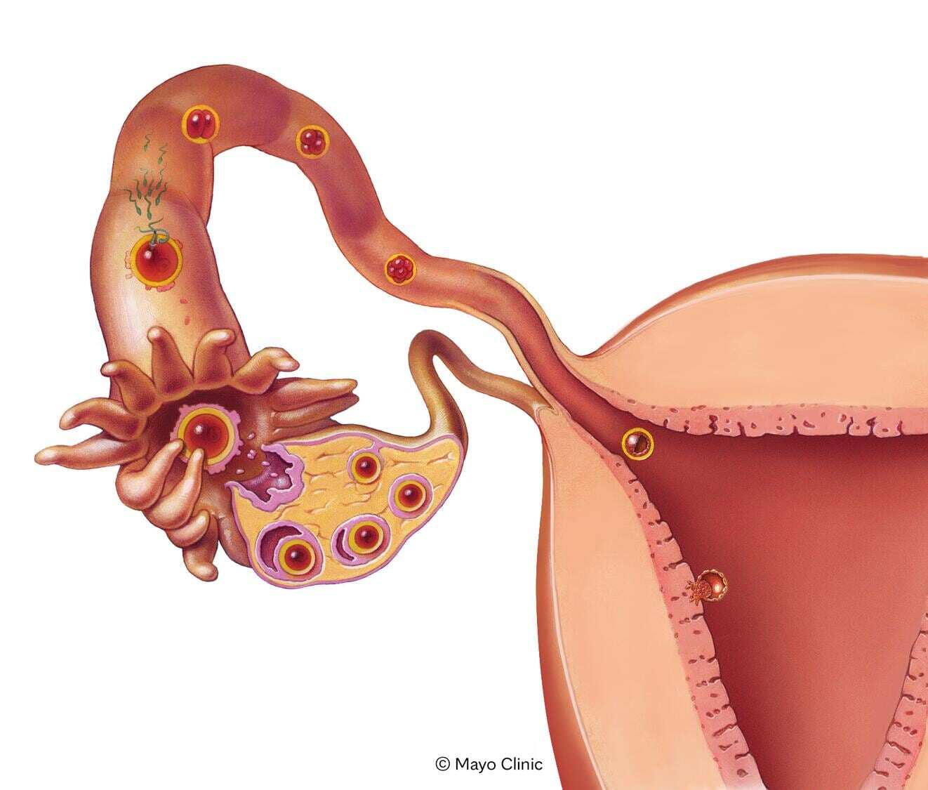 Egg being fertilized and implanting in the uterus