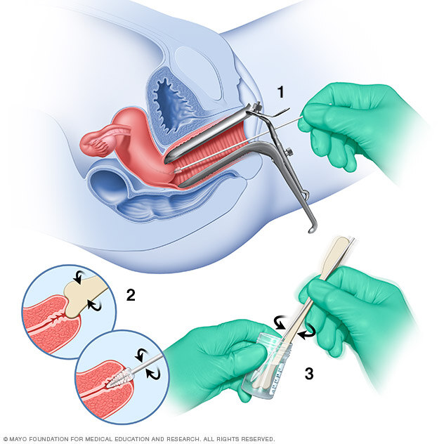 Pap test