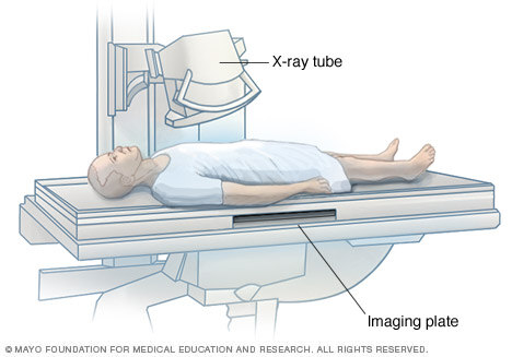 A person having an X-ray exam