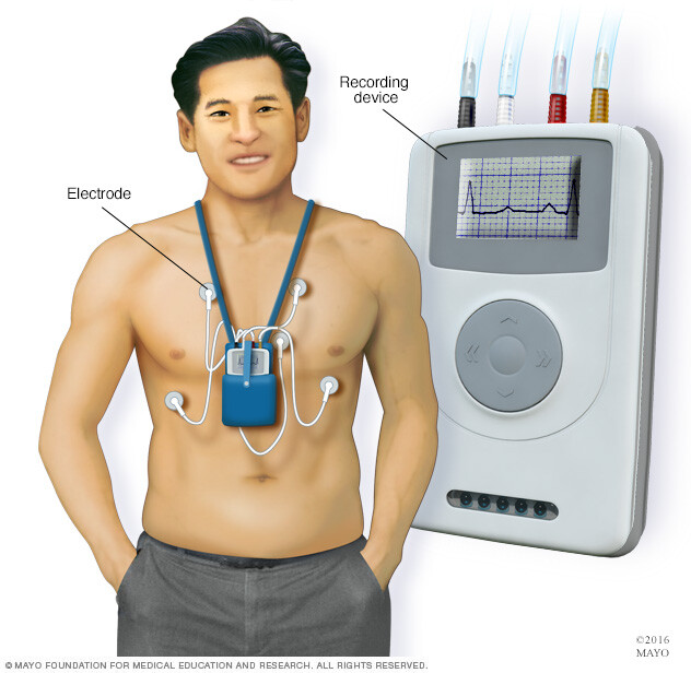 Holter monitor