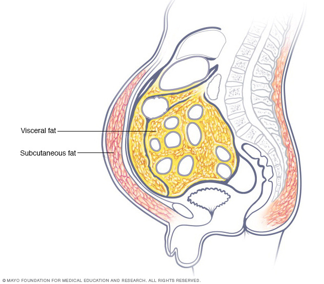 Illustration showing where belly fat builds up