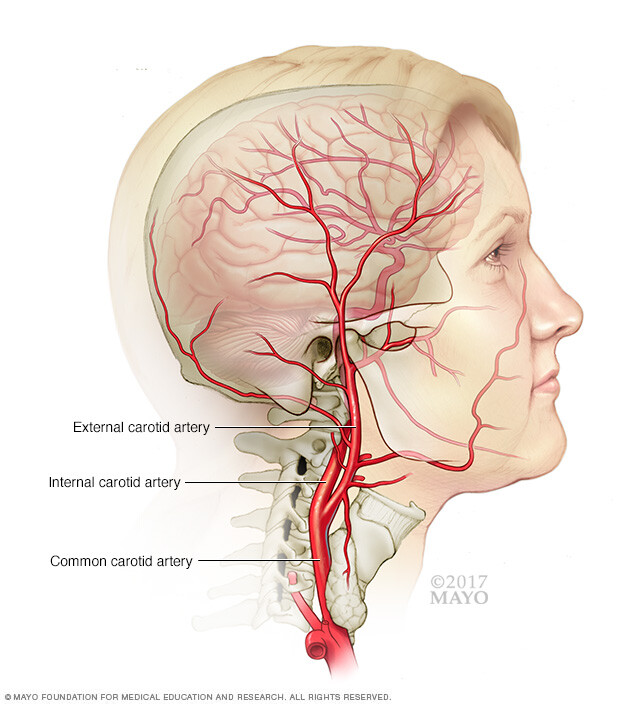 Carotid artery