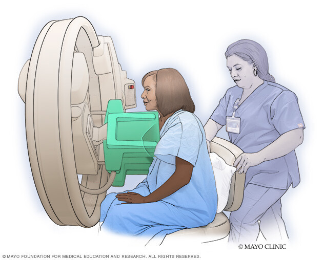 A patient undergoing molecular breast imaging