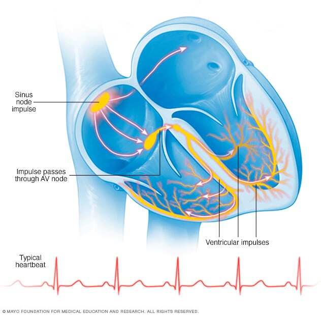 Typical heartbeat